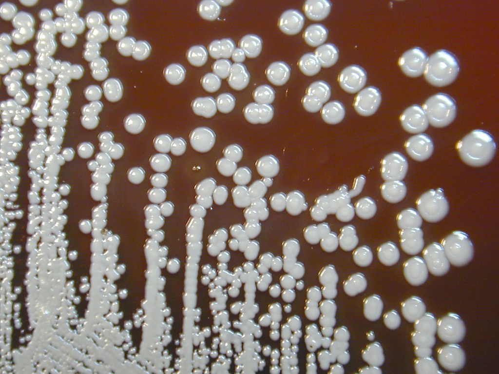 Colonies of Burkholderia pseudomallei bacteria grown on sheep blood agar over a period of 72 hours